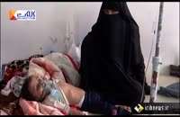 عدم توجه سازمان ملل در کشتار کودکان یمن